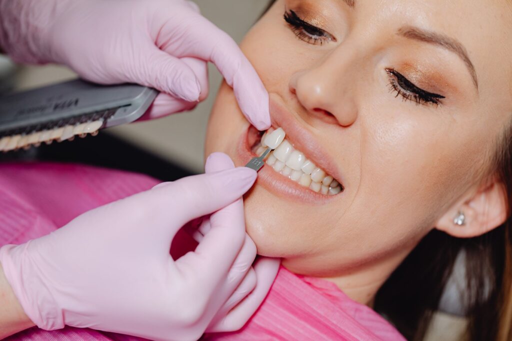Why Veneers Are A Popular Cosmetic Dentistry Option
