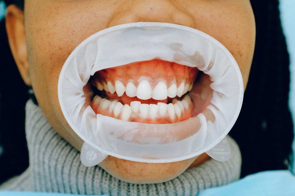 6 Questions To Ask About Maintaining Healthy Tooth Roots